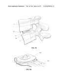 MODULAR, CUSTOMIZABLE SPINE STABILIZATION SYSTEM diagram and image