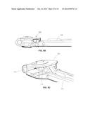 MODULAR, CUSTOMIZABLE SPINE STABILIZATION SYSTEM diagram and image