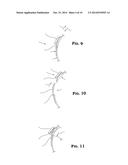 ASYMMETRICALLY RELEASABLE FASTENER SYSTEM AND CUFF FOR USE THEREWITH diagram and image