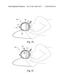 ELECTRICALLY STIMULATED MASK AND/OR ASSOCIATED COMPONENTS diagram and image