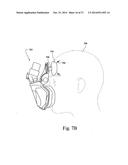 ELECTRICALLY STIMULATED MASK AND/OR ASSOCIATED COMPONENTS diagram and image