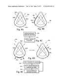 ELECTRICALLY STIMULATED MASK AND/OR ASSOCIATED COMPONENTS diagram and image