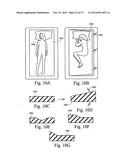 ELECTRICALLY STIMULATED MASK AND/OR ASSOCIATED COMPONENTS diagram and image