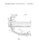 Drill Bit with Self-Adjusting Pads diagram and image