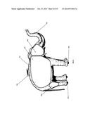 SUITCASE diagram and image