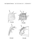 PROTECTIVE SYSTEM FOR LUGGAGE diagram and image