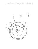 Method for generating a desired spatially variable temporal profile of the     magnetization state in magnetic resonance diagram and image