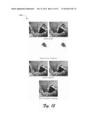 Stereoscopic Target Region Filling diagram and image