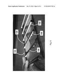 EXTERNALLY MOUNTED SHIELD FOR LED LUMINAIRE diagram and image