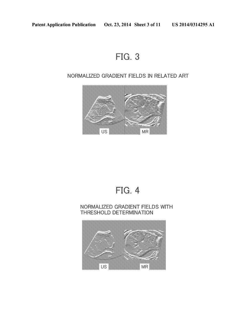 IMAGE PROCESSING METHOD AND APPARATUS AND PROGRAM - diagram, schematic, and image 04