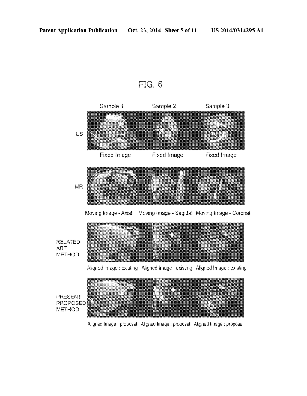 IMAGE PROCESSING METHOD AND APPARATUS AND PROGRAM - diagram, schematic, and image 06