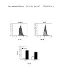 Compositions and Methods for Diagnosing and Treating Sjogren s Syndrome diagram and image