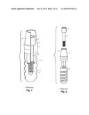 Laboratory Implant diagram and image