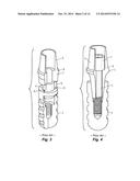 Laboratory Implant diagram and image