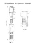 Laboratory Implant diagram and image