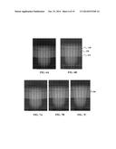 RAPID MEASUREMENT OF FORMED BLOOD COMPONENT SEDIMENTATION RATE FROM SMALL     SAMPLE VOLUMES diagram and image