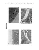 INHIBITION OF THE RENIN-ANGIOTENSIN SYSTEM FOR THE TREATMENT OF RENAL,     VASCULAR AND CARTILAGE PATHOLOGY diagram and image