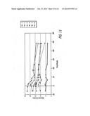 METHOD AND COMPOSITION FOR TREATING MIGRAINES diagram and image