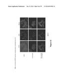 SMALL MOLECULE INHIBITORS OF IL-6 AND USES THEREOF diagram and image