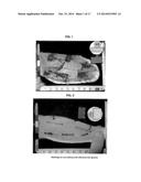 COMPOSITION FOR TREATMENT OF EPITHELIAL TISSUE diagram and image