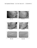 COMPOSITION FOR TREATMENT OF EPITHELIAL TISSUE diagram and image