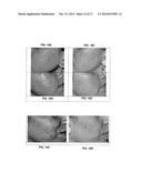 COMPOSITION FOR TREATMENT OF EPITHELIAL TISSUE diagram and image