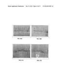 COMPOSITION FOR TREATMENT OF EPITHELIAL TISSUE diagram and image