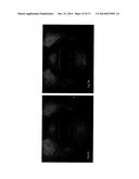 COMPOSITION FOR TREATMENT OF EPITHELIAL TISSUE diagram and image