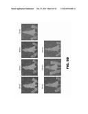 ANTIBODIES TO TIP-1 AND GRP78 diagram and image