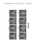 ANTIBODIES TO TIP-1 AND GRP78 diagram and image