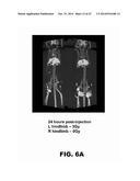 ANTIBODIES TO TIP-1 AND GRP78 diagram and image