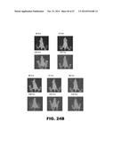 ANTIBODIES TO TIP-1 AND GRP78 diagram and image