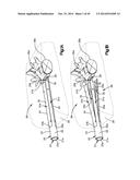 EXPANDABLE DILATOR diagram and image