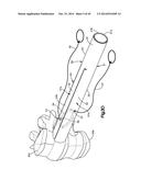 EXPANDABLE DILATOR diagram and image