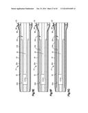 EXPANDABLE DILATOR diagram and image