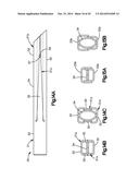 EXPANDABLE DILATOR diagram and image