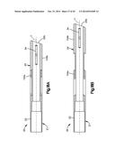 EXPANDABLE DILATOR diagram and image