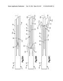 EXPANDABLE DILATOR diagram and image