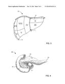 APPARATUS AND METHODS FOR ACCURATE SURFACE MATCHING OF ANATOMY USING A     PREDEFINED REGISTRATION PATH diagram and image