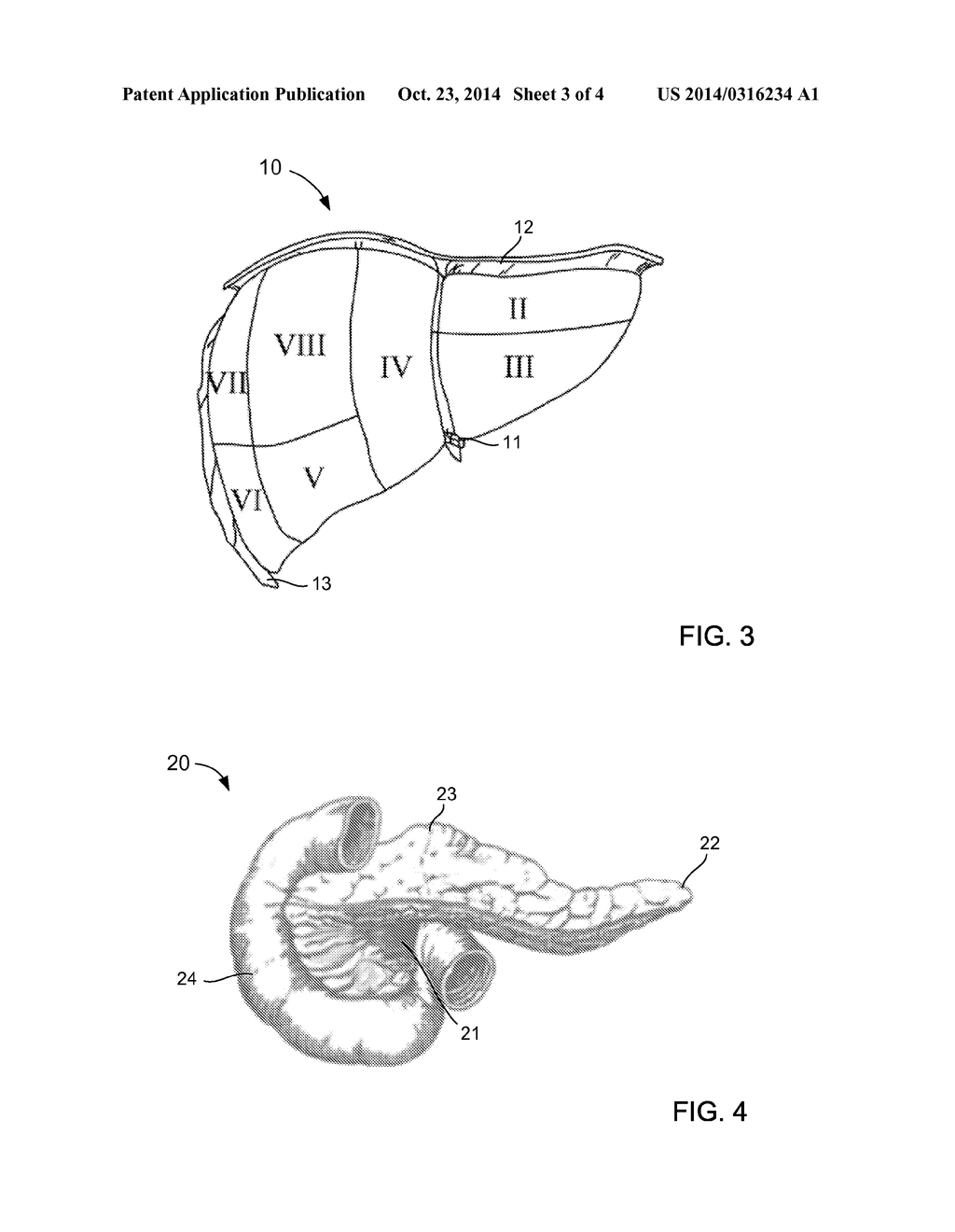 APPARATUS AND METHODS FOR ACCURATE SURFACE MATCHING OF ANATOMY USING A     PREDEFINED REGISTRATION PATH - diagram, schematic, and image 04