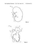 APPARATUS AND METHODS FOR ACCURATE SURFACE MATCHING OF ANATOMY USING A     PREDEFINED REGISTRATION PATH diagram and image