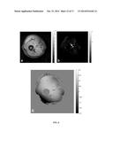 CHEMICAL EXCHANGE SATURATION TRANSFER ANGIOGRAPHY diagram and image