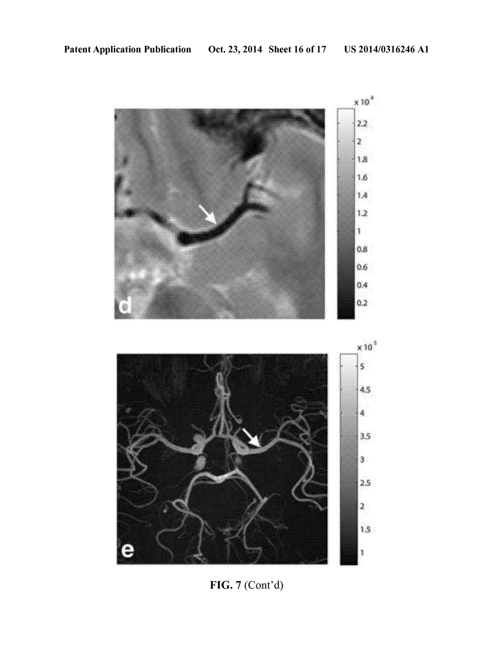 CHEMICAL EXCHANGE SATURATION TRANSFER ANGIOGRAPHY - diagram, schematic, and image 17