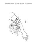 Vial-Mounted Micro Vein Enhancer diagram and image