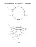 ULTRASOUND TREATMENT DEVICE AND METHODS OF USE diagram and image