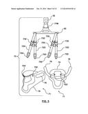 DYNAMIC LOGARITHMIC SPINAL DECOMPRESSION TABLE AND METHOD diagram and image