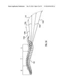 DYNAMIC LOGARITHMIC SPINAL DECOMPRESSION TABLE AND METHOD diagram and image