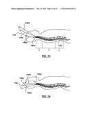 DYNAMIC LOGARITHMIC SPINAL DECOMPRESSION TABLE AND METHOD diagram and image