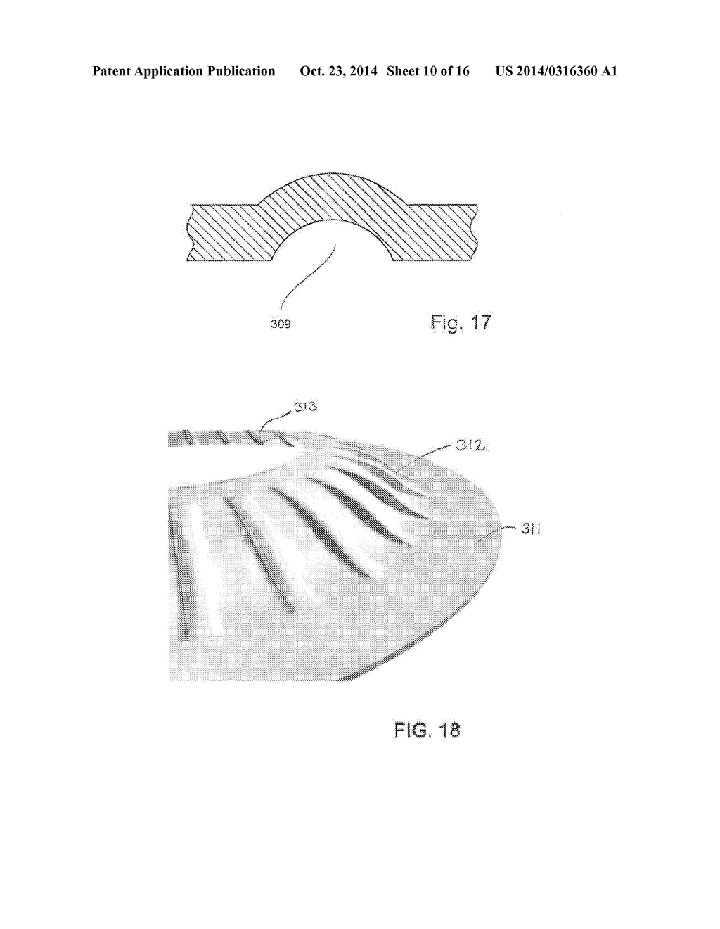 CONVEX SUPPORTING DEVICE - diagram, schematic, and image 11