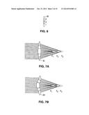 Method and Apparatus for Patterned Plasma-Mediated Laser Trephination of     the Lens Capsule and Three Dimensional Phaco- Segmentation diagram and image